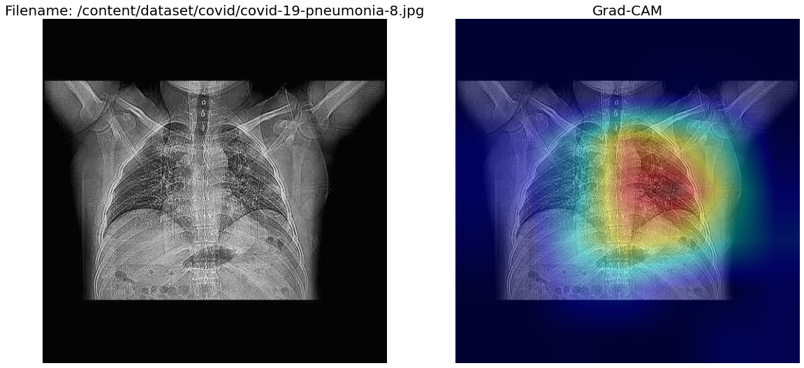 GradCAM for activation map visualization